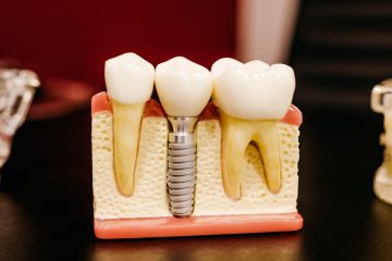 diş, implant, diş kökü, maket