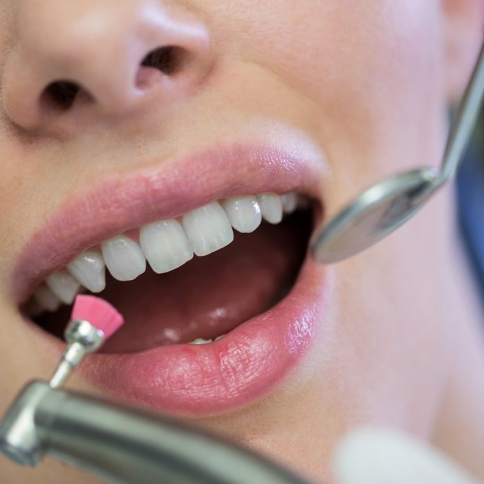 ağız ve diş sağlığı, hasta, kadın, dişler, diş uygulama, pembe, diş kliniği