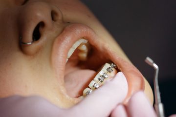 diş bakımı, diş tedavisi, kadın, ağız
