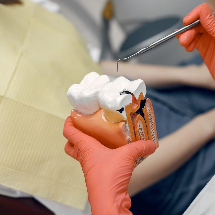 diş maketi, diş uygulama işlemi, klinik, diş hekimi