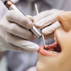 dişçilik, diş uygulaması, kadın hasta, ağız sağlığı