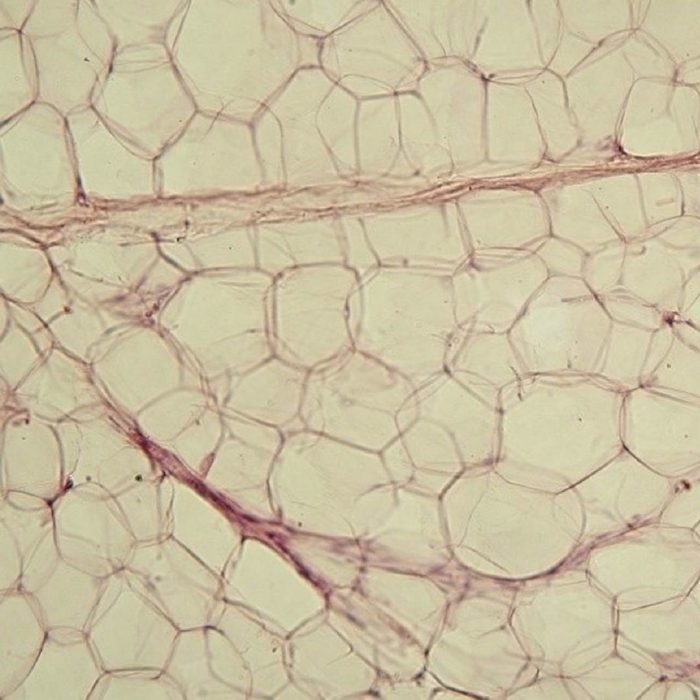 adiposit hücreleri, yağ hücresi