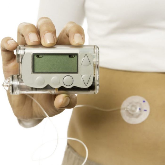 insülin pompası, diyabet cihazı, şeker hastası pompa