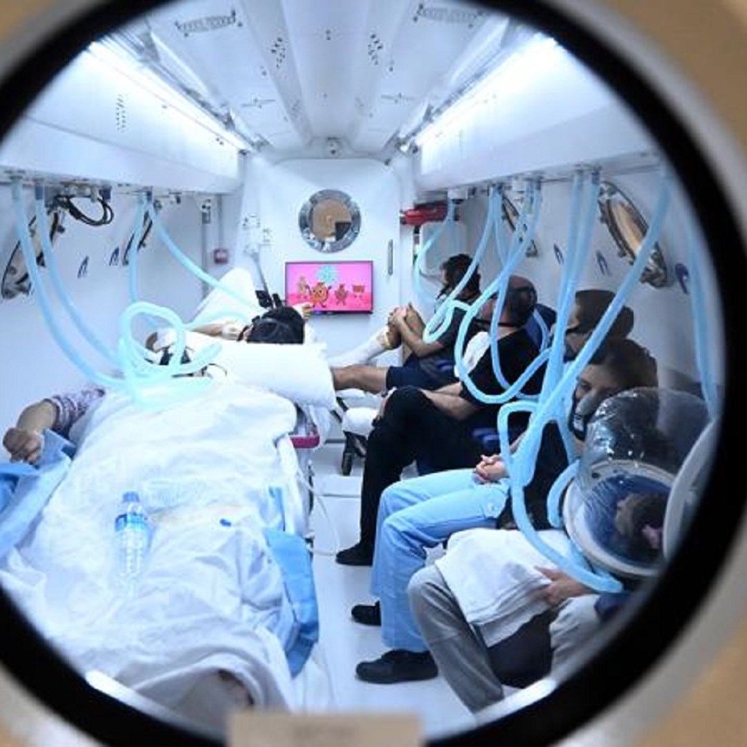 hiperbarik oksijen tedavisi